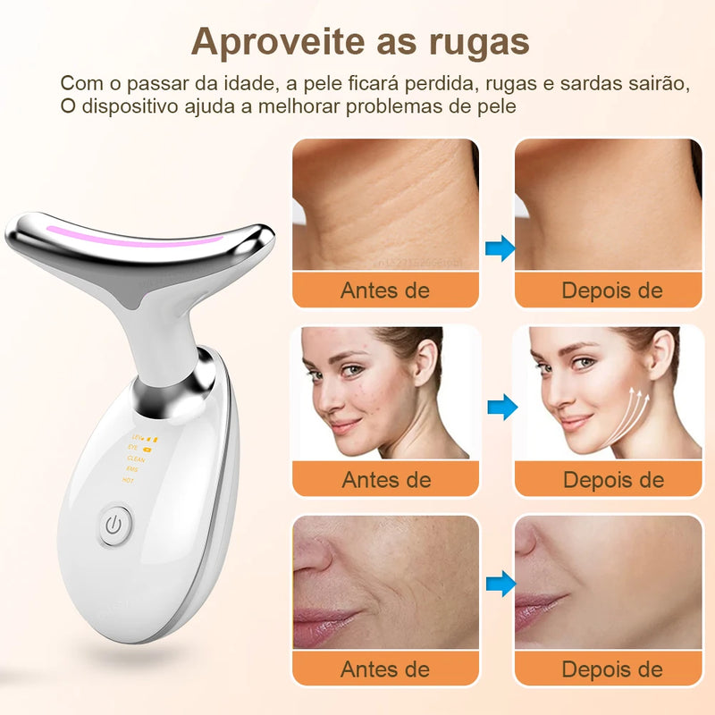 Rejuvenescedor facial removedor de rugas marcas e papadas a laser